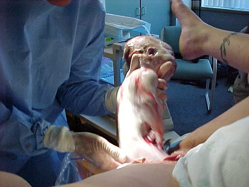 Слуховой Аппарат Краснознаменск Купить